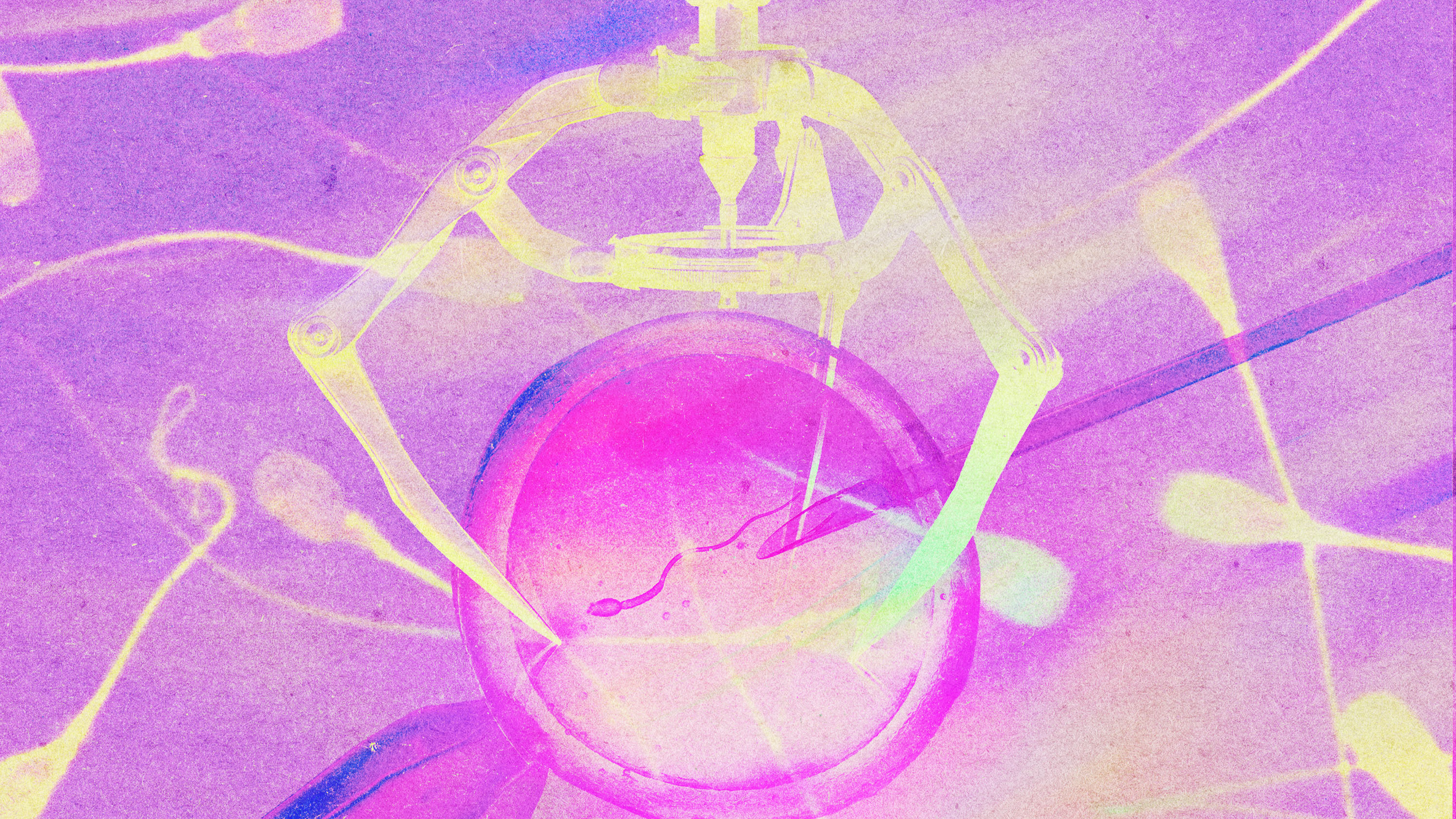 A photo illustration shows a robotic arm assisting in IVF.