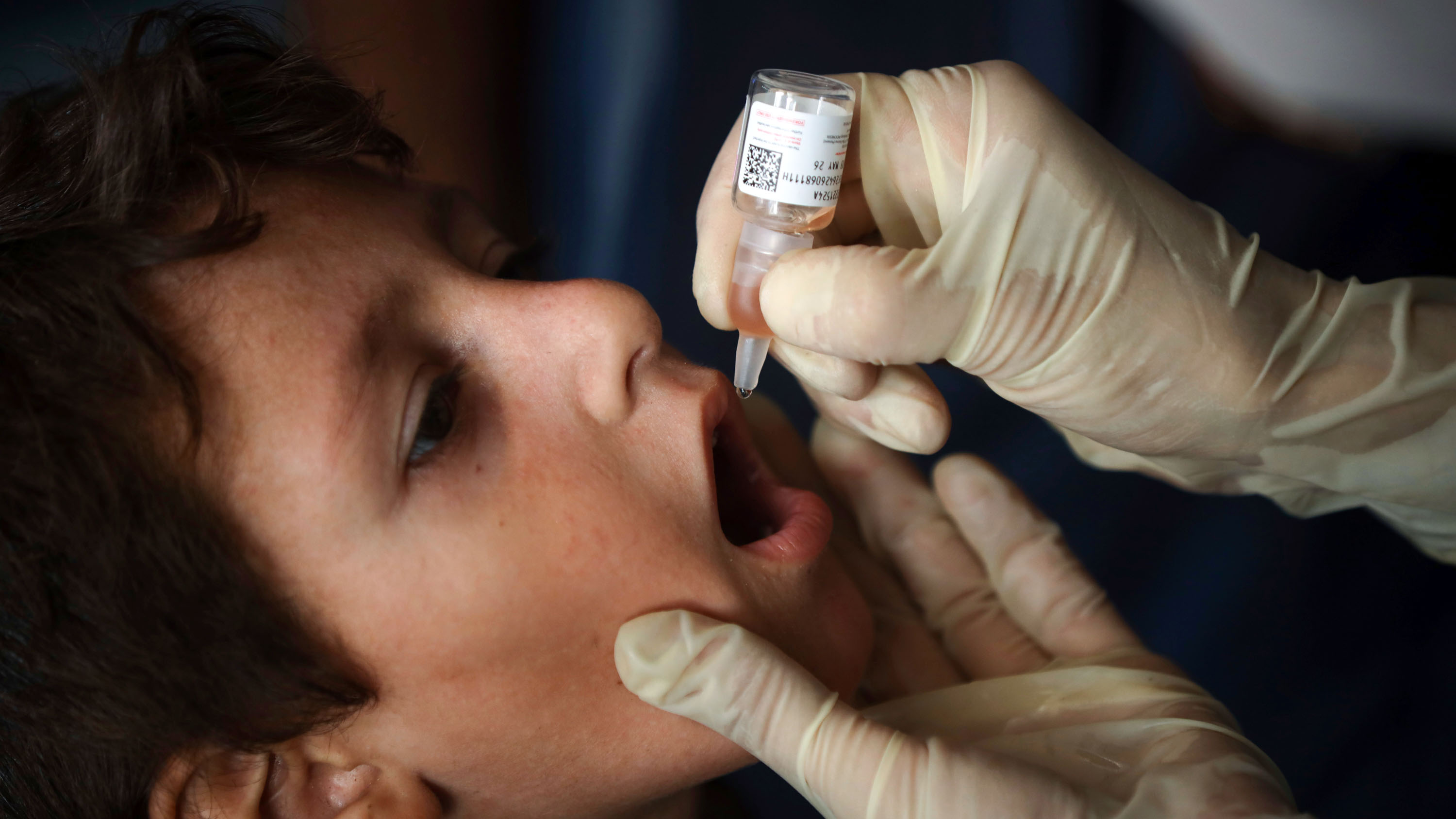 A gloved hand holds the chin of a small boy and while the other hand drips a polio vaccine into his mouth